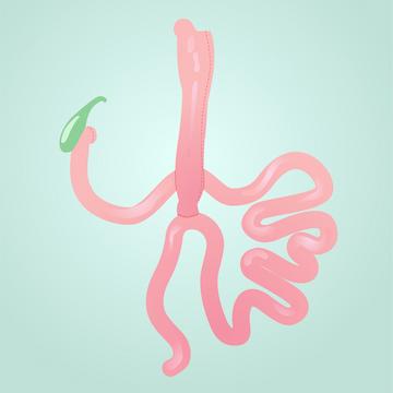 Duodenal Switch or SADI-S